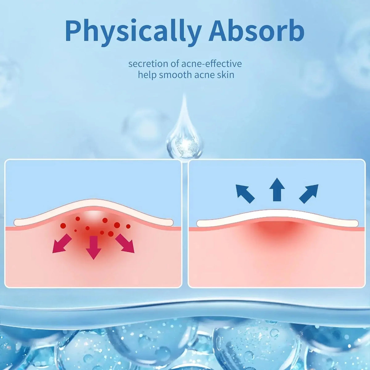 360pcs Face Acne Patch Invisible Skin Care Pimple Acne Patches Anti-inflammatory Healing Absorbing Spot Sticker Covering Acn…