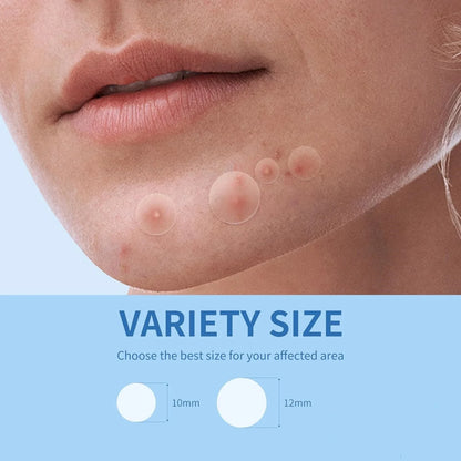 360pcs Face Acne Patch Invisible Skin Care Pimple Acne Patches Anti-inflammatory Healing Absorbing Spot Sticker Covering Acn…