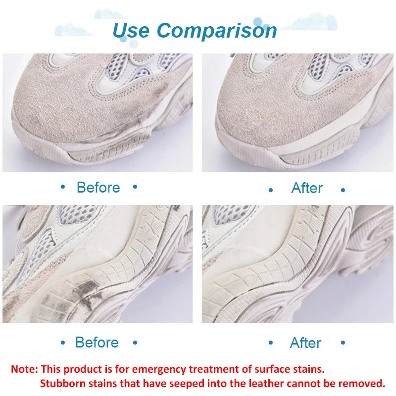 Suede & Sneaker Shoes Cleaning Eraser Matte Leather Shoes Care Whitening Velvet Leather Revitalizer & Stain Remover Tool - i…